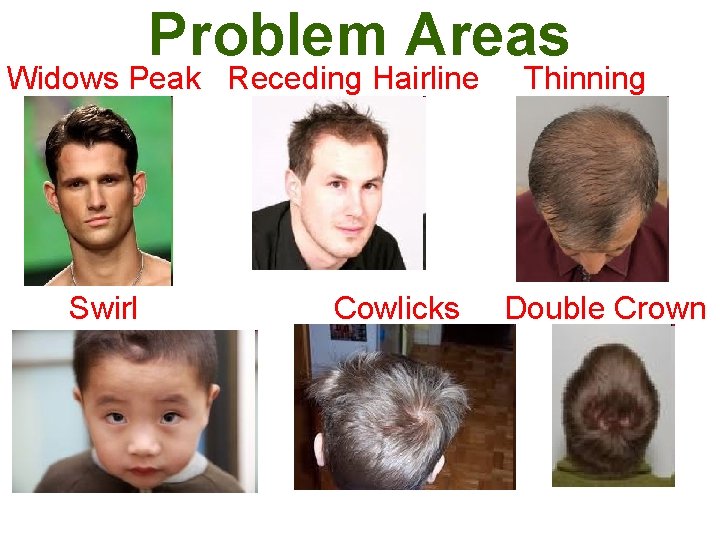 Problem Areas Widows Peak Receding Hairline Swirl Cowlicks Thinning Double Crown 