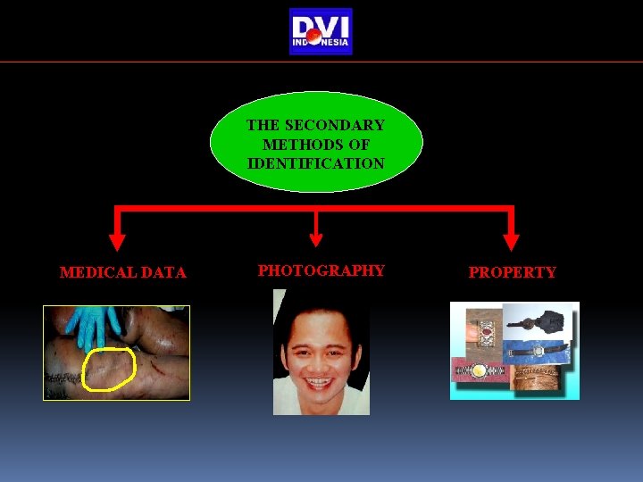 THE SECONDARY METHODS OF IDENTIFICATION MEDICAL DATA PHOTOGRAPHY PROPERTY THE SECONDARY METHODS OF IDENTIFICATION MEDICAL DATA PHOTOGRAPHY PROPERTY