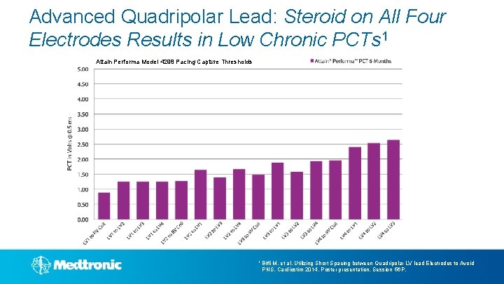 Advanced Quadripolar Lead: Steroid on All Four Electrodes Results in Low Chronic PCTs 1