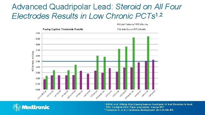 Advanced Quadripolar Lead: Steroid on All Four Electrodes Results in Low Chronic PCTs 1,