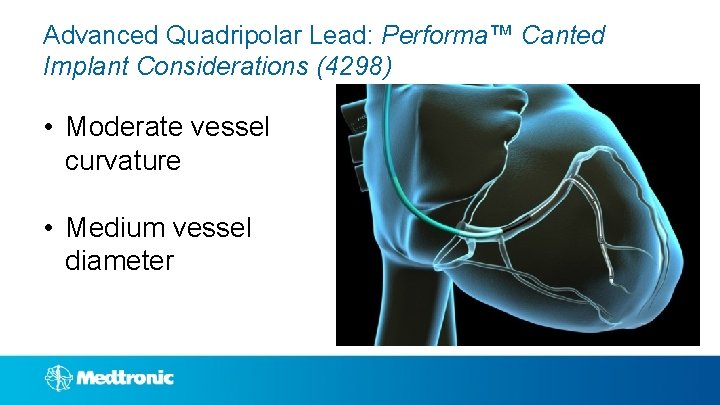 Advanced Quadripolar Lead: Performa™ Canted Implant Considerations (4298) • Moderate vessel curvature • Medium