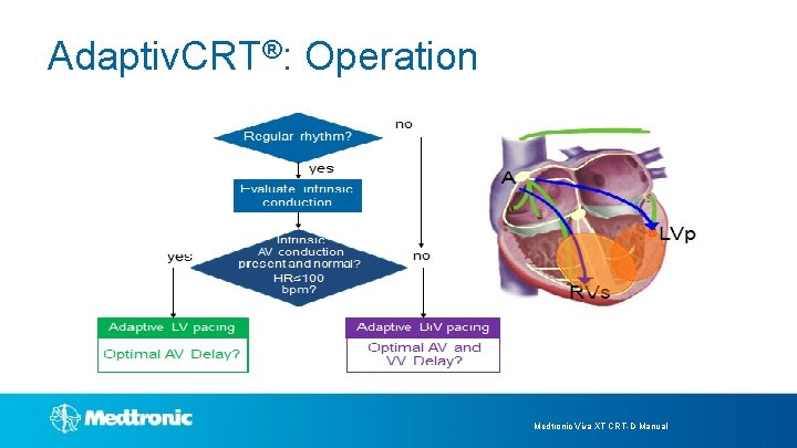 Adaptiv. CRT®: Operation Medtronic Viva XT CRT-D Manual 