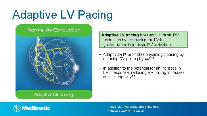 Adaptive LV Pacing Adaptive LV pacing leverages intrinsic RV conduction by pre-pacing the LV