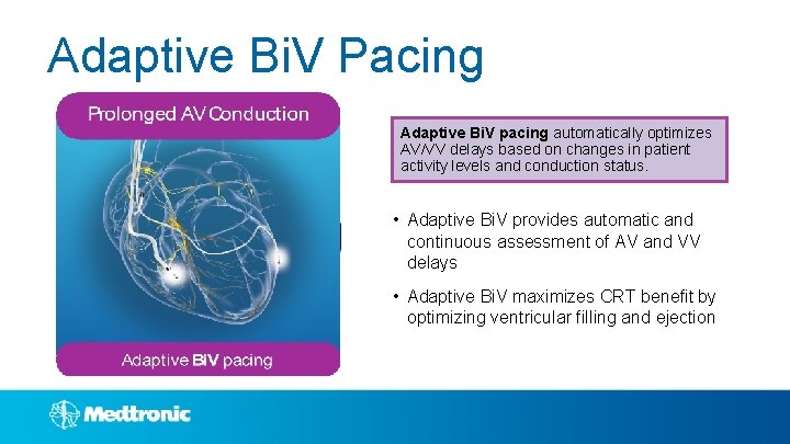 Adaptive Bi. V Pacing Adaptive Bi. V pacing automatically optimizes AV/VV delays based on