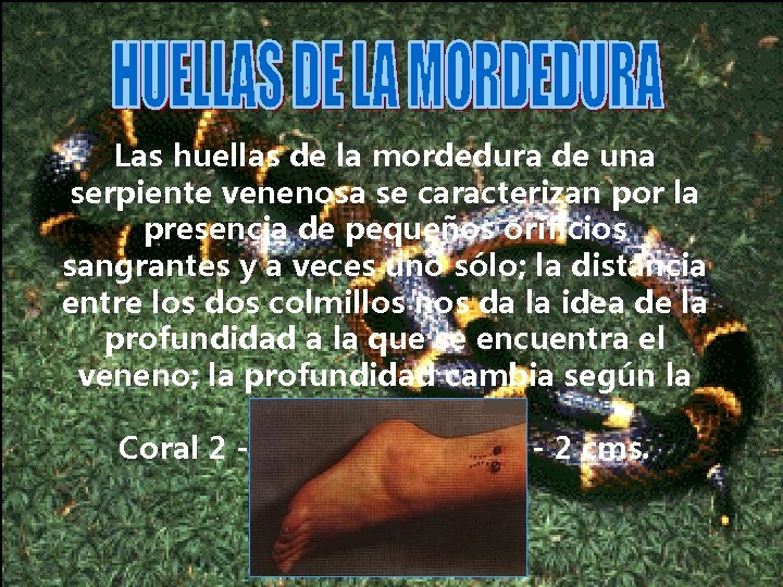 Las huellas de la mordedura de una serpiente venenosa se caracterizan por la presencia