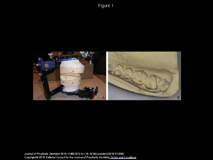 Figure 1 Journal of Prosthetic Dentistry 2015 11492 -97 DOI: (10. 1016/j. prosdent. 2015.