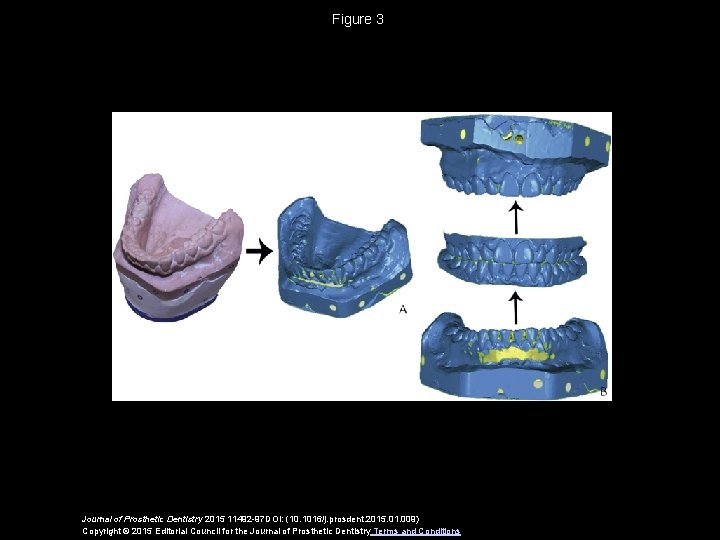 Figure 3 Journal of Prosthetic Dentistry 2015 11492 -97 DOI: (10. 1016/j. prosdent. 2015.