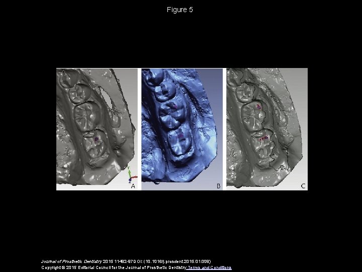 Figure 5 Journal of Prosthetic Dentistry 2015 11492 -97 DOI: (10. 1016/j. prosdent. 2015.