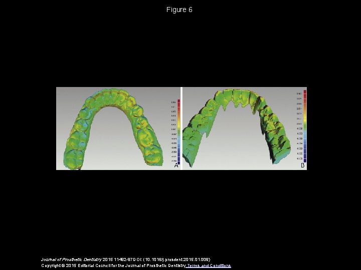 Figure 6 Journal of Prosthetic Dentistry 2015 11492 -97 DOI: (10. 1016/j. prosdent. 2015.