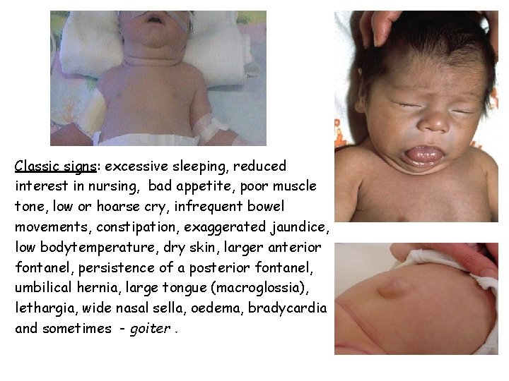 Classic signs: excessive sleeping, reduced interest in nursing, bad appetite, poor muscle tone, low Classic signs: excessive sleeping, reduced interest in nursing, bad appetite, poor muscle tone, low