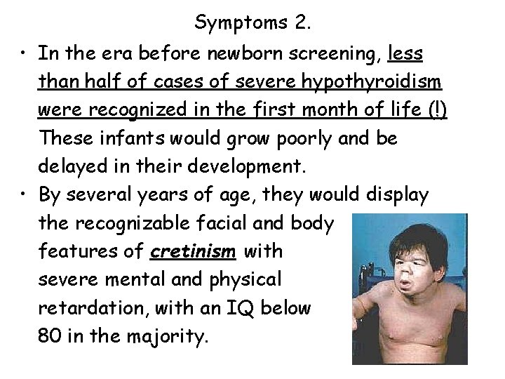 Symptoms 2. • In the era before newborn screening, less than half of cases Symptoms 2. • In the era before newborn screening, less than half of cases