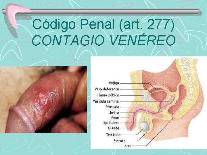 Código Penal (art. 277) CONTAGIO VENÉREO 