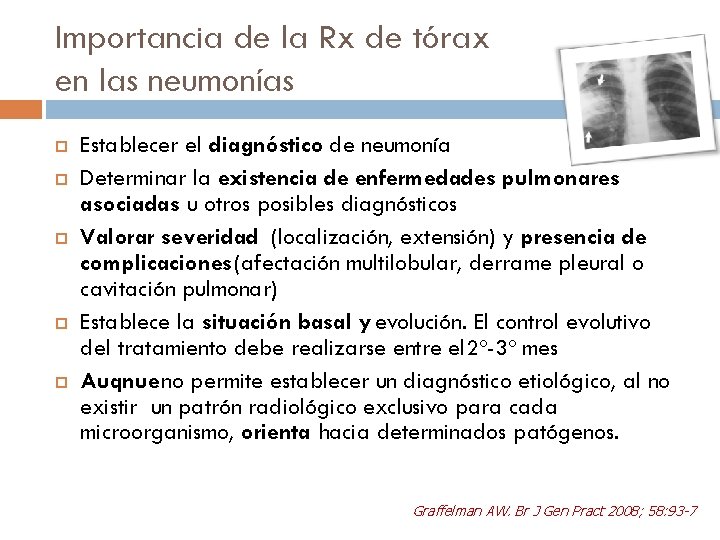 Importancia de la Rx de tórax en las neumonías Establecer el diagnóstico de neumonía