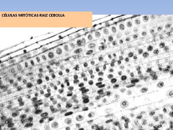 CÉLULAS MITÓTICAS RAIZ CEBOLLA 