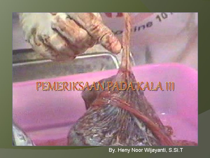 PEMERIKSAAN PADA KALA III By. Heny Noor Wijayanti, S. Si. T 