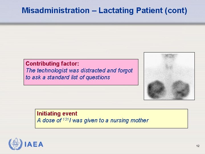 Misadministration – Lactating Patient (cont) Contributing factor: The technologist was distracted and forgot to