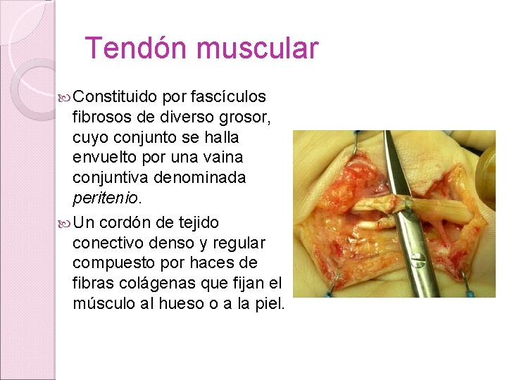 Tendón muscular Constituido por fascículos fibrosos de diverso grosor, cuyo conjunto se halla envuelto