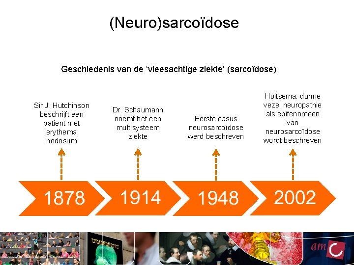 (Neuro)sarcoïdose Geschiedenis van de ‘vleesachtige ziekte’ (sarcoïdose) Sir J. Hutchinson beschrijft een patient met