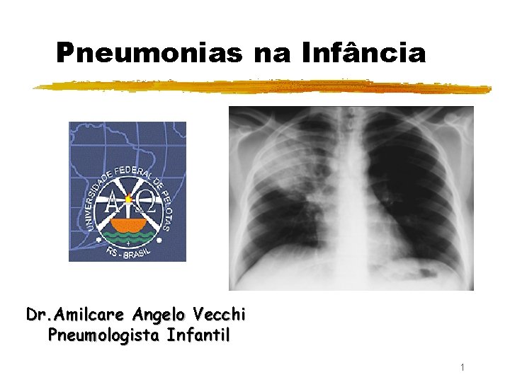 Pneumonias na Infância Dr. Amilcare Angelo Vecchi Pneumologista Infantil 1 