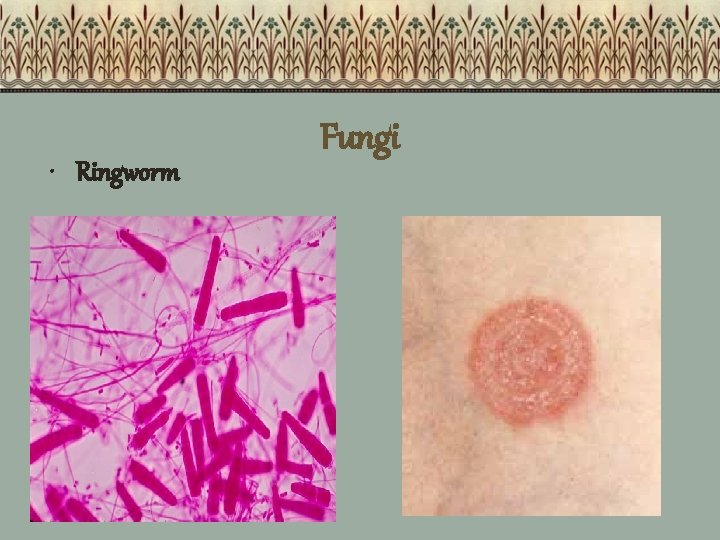  • Ringworm Fungi 