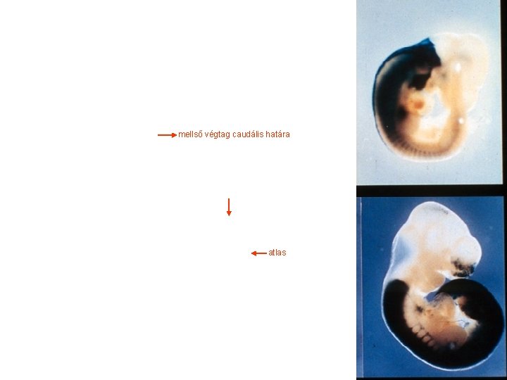 mellső végtag caudális határa atlas 