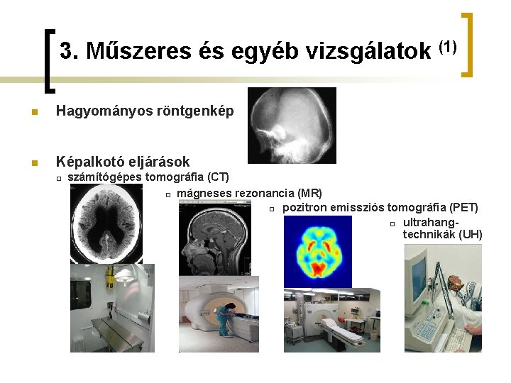 3. Műszeres és egyéb vizsgálatok (1) n Hagyományos röntgenkép n Képalkotó eljárások □ számítógépes