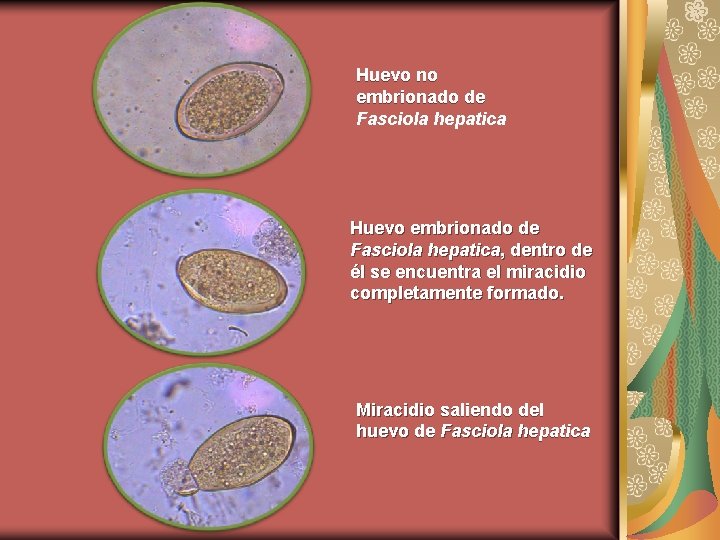 Huevo no embrionado de Fasciola hepatica Huevo embrionado de Fasciola hepatica, dentro de él