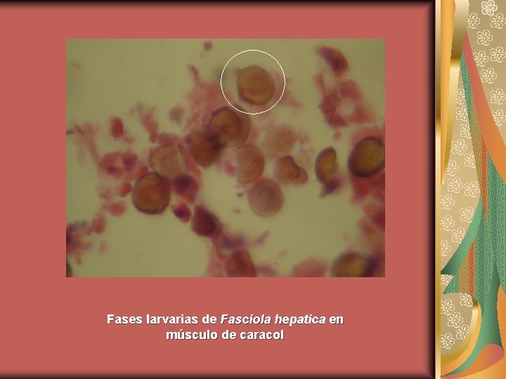 Fases larvarias de Fasciola hepatica en músculo de caracol 