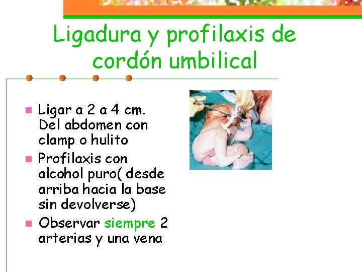 Ligadura y profilaxis de cordón umbilical n n n Ligar a 2 a 4 Ligadura y profilaxis de cordón umbilical n n n Ligar a 2 a 4