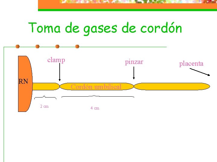 Toma de gases de cordón clamp RN pinzar Cordón umbilical 2 cm 4 cm