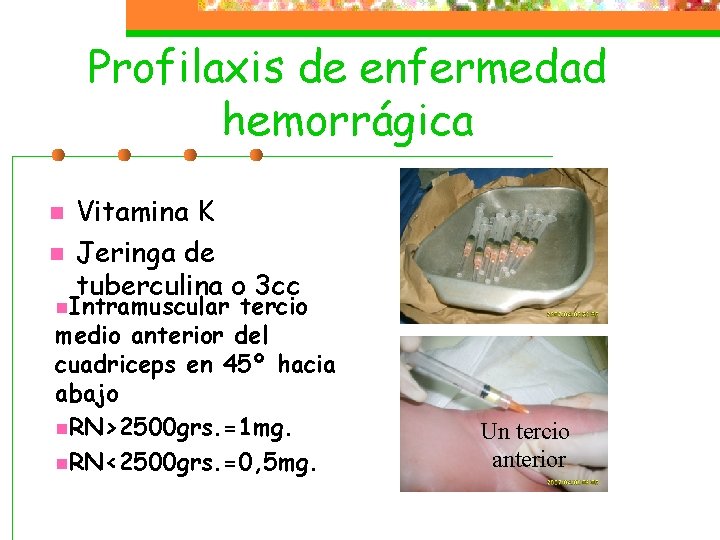 Profilaxis de enfermedad hemorrágica n n Vitamina K Jeringa de tuberculina o 3 cc