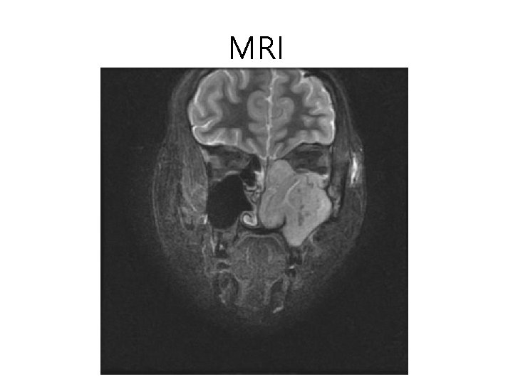 MRI 