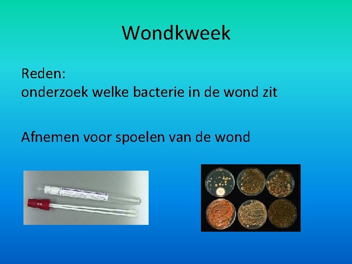 Wondkweek Reden: onderzoek welke bacterie in de wond zit Afnemen voor spoelen van de