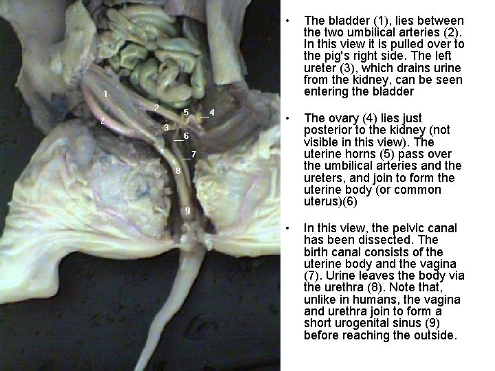  • The bladder (1), lies between the two umbilical arteries (2). In this