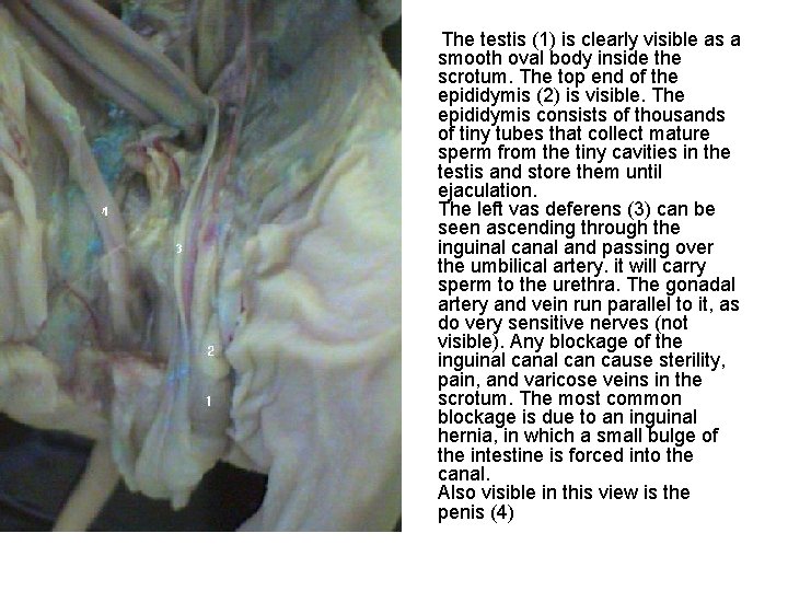 The testis (1) is clearly visible as a smooth oval body inside the scrotum.