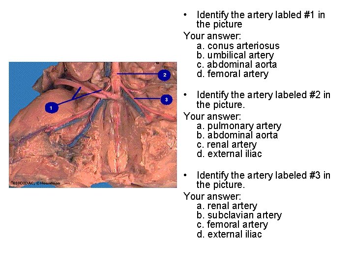  • Identify the artery labled #1 in the picture Your answer: a. conus