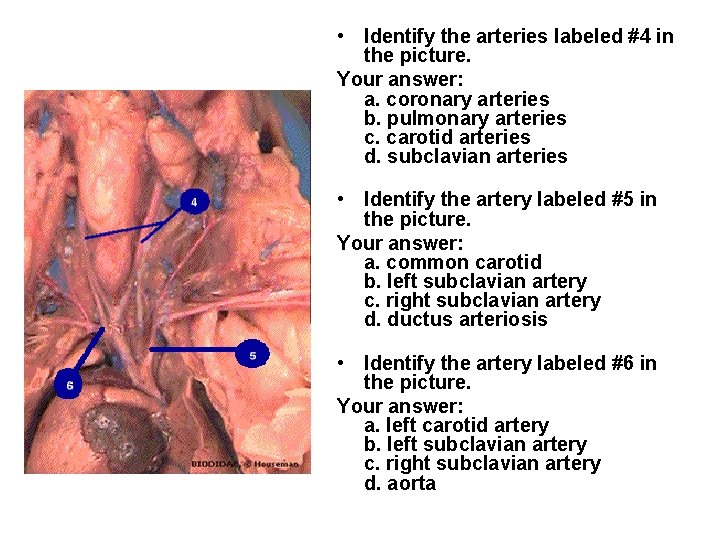  • Identify the arteries labeled #4 in the picture. Your answer: a. coronary