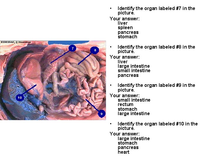  • Identify the organ labeled #7 in the picture. Your answer: liver spleen