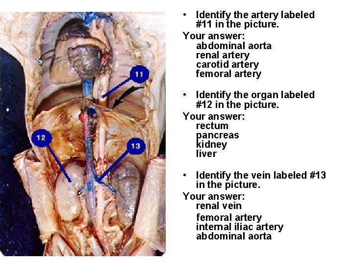  • Identify the artery labeled #11 in the picture. Your answer: abdominal aorta