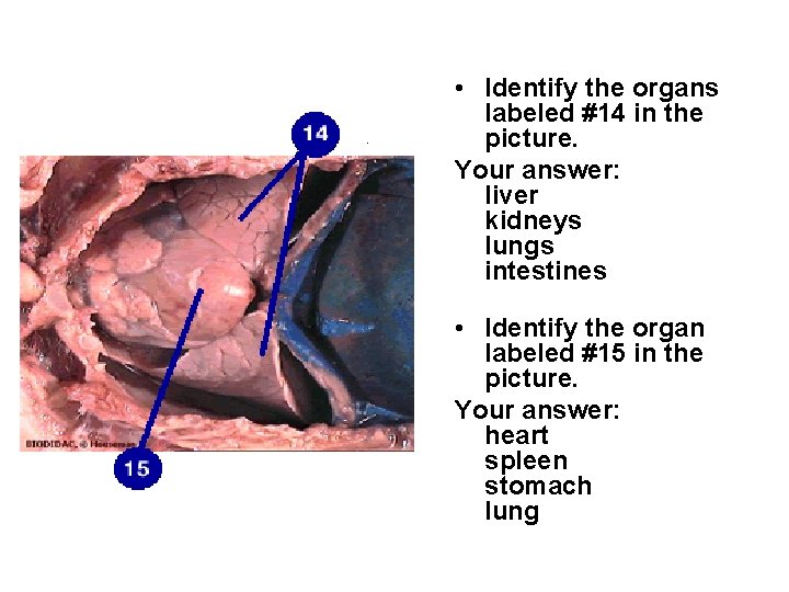  • Identify the organs labeled #14 in the picture. Your answer: liver kidneys