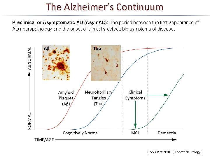 The Alzheimer’s Continuum Preclinical or Asymptomatic AD (Asym. AD): The period between the first