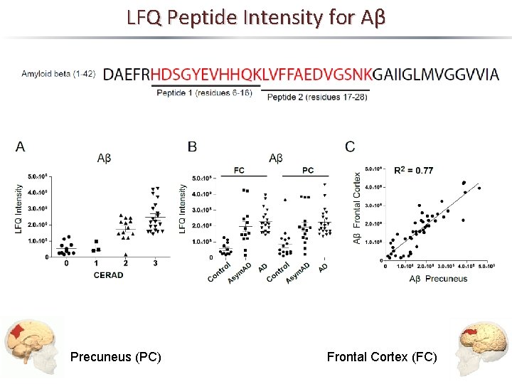 LFQ Peptide Intensity for Aβ Precuneus (PC) Frontal Cortex (FC) 