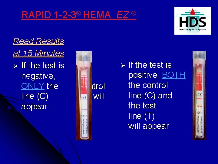 RAPID 1 -2 -3® HEMA EZ ® Read Results at 15 Minutes Ø If