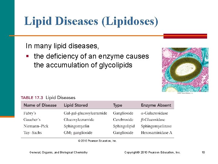 Lipid Diseases (Lipidoses) In many lipid diseases, § the deficiency of an enzyme causes