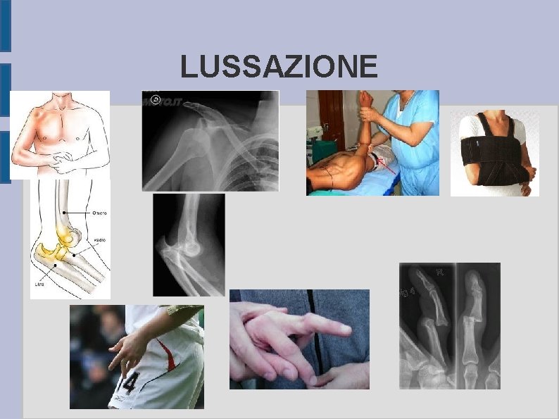 LUSSAZIONE 