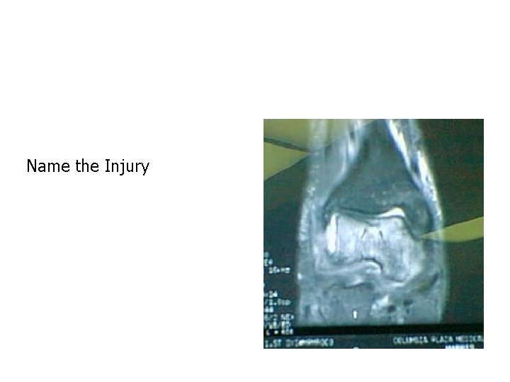 Name the Injury 