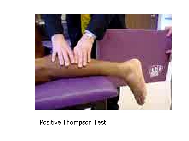 Positive Thompson Test 