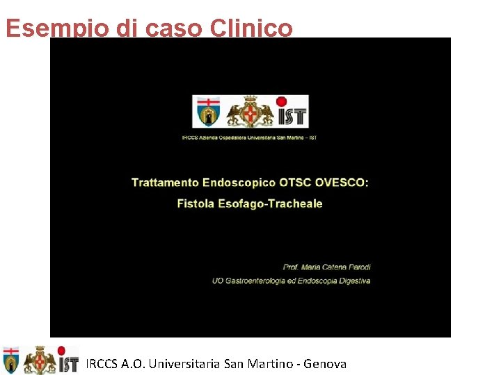 Esempio di caso Clinico IRCCS A. O. Universitaria San Martino - Genova 