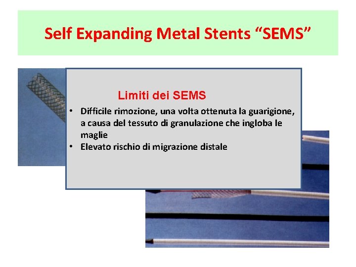 Self Expanding Metal Stents “SEMS” Limiti dei SEMS • Difficile rimozione, una volta ottenuta