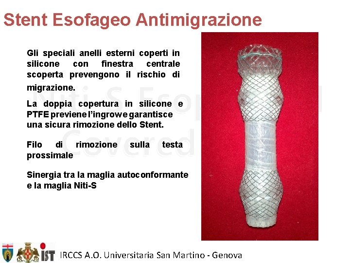 Stent Esofageo Antimigrazione Gli speciali anelli esterni coperti in silicone con finestra centrale scoperta